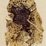 A lung with coal workers’ pneumoconiosis and progressive massive fibrosis, also known as severe black lung disease. Photos courtesy of CDC-NIOSH
