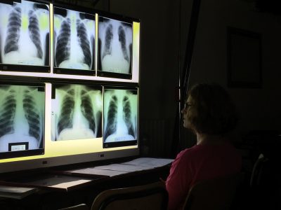 person evaluating x-rays